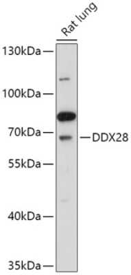 Western Blot: DDX28 Antibody [NBP2-92376] - Analysis of extracts of Rat lung, using DDX28 at 1:1000 dilution.Secondary antibody: HRP Goat Anti-Rabbit IgG (H+L) at 1:10000 dilution.Lysates/proteins: 25ug per lane.Blocking buffer: 3% nonfat dry milk in TBST.Detection: ECL Basic Kit .Exposure time: 60s.