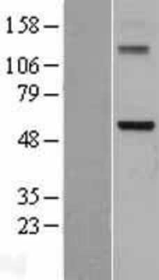 Western Blot: DDX28 Overexpression Lysate (Adult Normal) [NBL1-09791] Left-Empty vector transfected control cell lysate (HEK293 cell lysate); Right -Over-expression Lysate for DDX28.