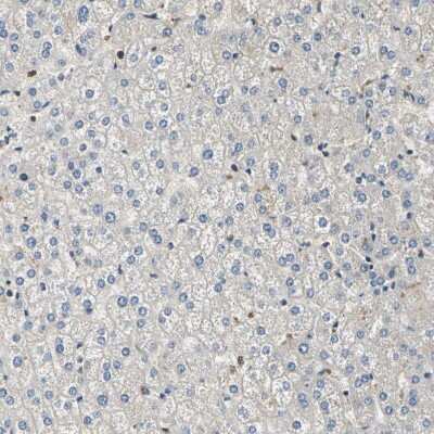 Immunohistochemistry-Paraffin: DDX3 Antibody [NBP1-85290] - Staining of human liver shows weak cytoplasmic positivity in hepatocytes.