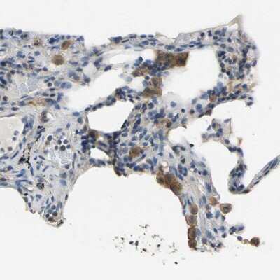 Immunohistochemistry-Paraffin: DDX3 Antibody [NBP1-85290] - Staining of human lung shows moderate cytoplasmic positivity in macrophages.