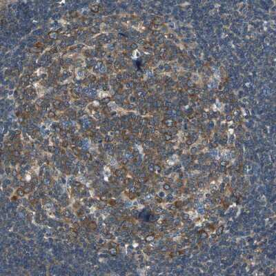 Immunohistochemistry-Paraffin: DDX3 Antibody [NBP1-85290] - Staining of human lymphoid tissues shows moderate cytoplasmic positivity in germinal center cells.