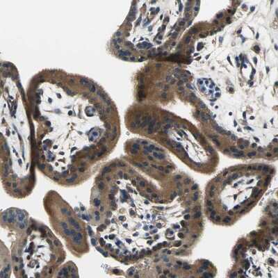 Immunohistochemistry-Paraffin: DDX3 Antibody [NBP1-85290] - Staining of human placenta shows moderate cytoplasmic positivity in trophoblastic cells.