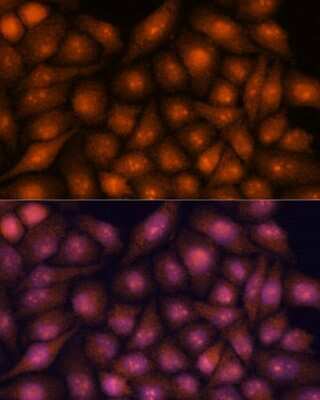 Immunocytochemistry/Immunofluorescence: DDX31 Antibody [NBP2-92273] - Analysis of HeLa cells using DDX31 at dilution of 1:100. Blue: DAPI for nuclear staining.