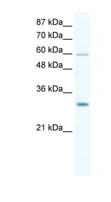 Western Blot: DDX31 Antibody [NBP1-57349] - Jurkat cell lysate, concentration 2.5 ug/ml.