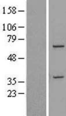 Western Blot: DDX31 Overexpression Lysate (Adult Normal) [NBL1-09792] Left-Empty vector transfected control cell lysate (HEK293 cell lysate); Right -Over-expression Lysate for DDX31.
