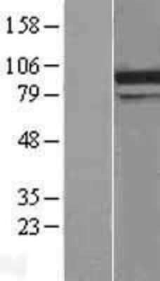 Western Blot: DDX31 Overexpression Lysate (Adult Normal) [NBL1-09793] Left-Empty vector transfected control cell lysate (HEK293 cell lysate); Right -Over-expression Lysate for DDX31.