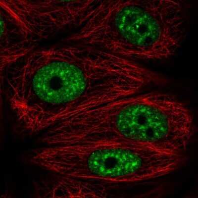 Immunocytochemistry/Immunofluorescence: DDX39 Antibody [NBP2-46824] - Staining of human cell line MCF7 shows localization to nuclear speckles.