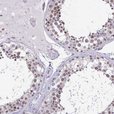 Immunohistochemistry-Paraffin: DDX39 Antibody [NBP2-46824] - Staining of human testis shows moderate nuclear positivity in cells in seminiferus ducts.