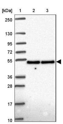 Western Blot: DDX39 Antibody [NBP2-46824] - Lane 1: Marker  [kDa] 250, 130, 95, 72, 55, 36, 28, 17, 10.  Lane 2: Human cell line RT-4.  Lane 3: Human cell line U-251 MG