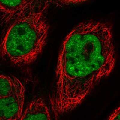 Immunocytochemistry/ Immunofluorescence DDX42 Antibody