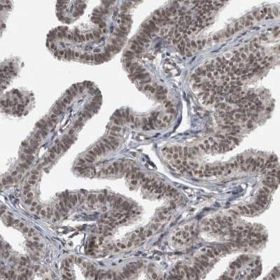 Immunohistochemistry-Paraffin DDX42 Antibody