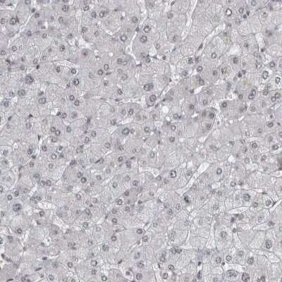 Immunohistochemistry-Paraffin DDX42 Antibody