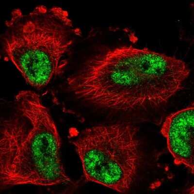 <b>Independent Antibodies Validation. </b>Immunocytochemistry/Immunofluorescence: DDX46 Antibody [NBP2-56227] - Staining of human cell line U-251 MG shows localization to nuclear speckles. Antibody staining is shown in green.