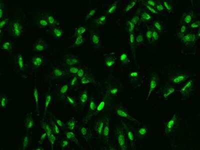 Immunocytochemistry/Immunofluorescence: DDX46 Antibody [NBP2-98581] - Immunofluorescence staining of DDX46 in U251MG cells. Cells were fixed with 4% PFA, permeabilzed with 0.1% Triton X-100 in PBS, blocked with 10% serum, and incubated with rabbit anti-Human DDX46 polyclonal antibody (dilution ratio 1:200) at 4C overnight. Then cells were stained with the Alexa Fluor(R)488-conjugated Goat Anti-rabbit IgG secondary antibody (green). Positive staining was localized to Nucleus.