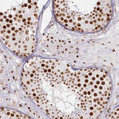 Immunohistochemistry-Paraffin DDX46 Antibody