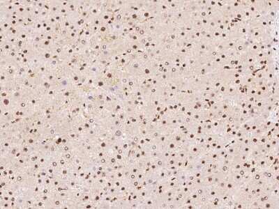 Immunohistochemistry-Paraffin: DDX46 Antibody [NBP2-98581] - Immunochemical staining of human DDX46 in human liver with rabbit polyclonal antibody at 1:100 dilution, formalin-fixed paraffin embedded sections.