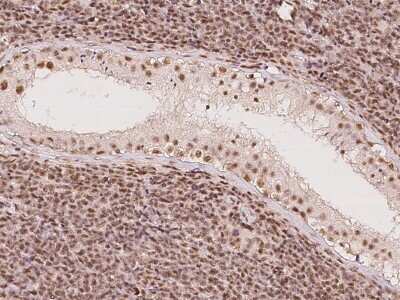 Immunohistochemistry-Paraffin: DDX46 Antibody [NBP2-98581] - Immunochemical staining of human DDX46 in human testis with rabbit polyclonal antibody at 1:100 dilution, formalin-fixed paraffin embedded sections.