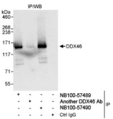 <b>Independent Antibodies Validation. </b>Immunoprecipitation: DDX46 Antibody [NB100-57489] - Detection of Human DDX46 by Western Blot of Immunoprecipitates. Samples: Whole cell lysate (1 mg for IP, 20% of IP loaded) from HeLa cells. Antibodies: Affinity purified rabbit anti-DDX46 antibody NB100-57489 used for IP at 3 mcg/mg lysate. DDX46 was also immunoprecipitated by rabbit anti-DDX46 antibody NB100-57490, which recognizes a downstream epitope. Detection: Chemiluminescence with an exposure time of 3 seconds.