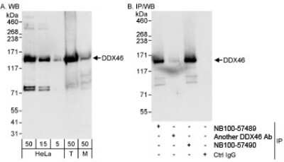 Western Blot: DDX46 Antibody [NB100-57490] - Whole cell lysate from HeLa (5, 15 and 50 ug for WB; 1 mg for IP, 20% of IP loaded), 293T (T; 50 ug) and mouse NIH3T3 (M; 50 ug) cells.  NB100-57490 used for WB at 0.04 ug/ml (A) and 1 ug/ml (B) and used for IP at 3 ug/mg lysate. DDX46 was also immunoprecipitated by rabbit anti-DDX46 antibody NB100-57489, which recognizes an upstream epitope.