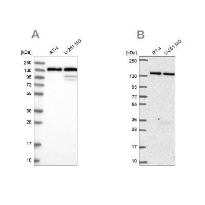 Western Blot DDX46 Antibody