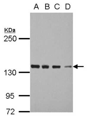 Western Blot: DDX46 Antibody [NBP2-16138] - Sample (30 ug of whole cell lysate) A: 293T B: A431 C: HeLa D: HepG2 5% SDS PAGE gel, diluted at 1:3000.