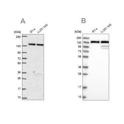 Western Blot: DDX46 Antibody [NBP2-56227] - Analysis using Anti-DDX46 antibody NBP2-56227 (A) shows similar pattern to independent antibody NBP1-83565 (B).