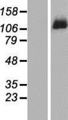 Western Blot: DDX46 Overexpression Lysate (Adult Normal) [NBP2-07275] Left-Empty vector transfected control cell lysate (HEK293 cell lysate); Right -Over-expression Lysate for DDX46.