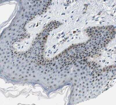 Immunohistochemistry-Paraffin DDX47 Antibody