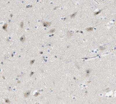 Immunohistochemistry-Paraffin DDX47 Antibody