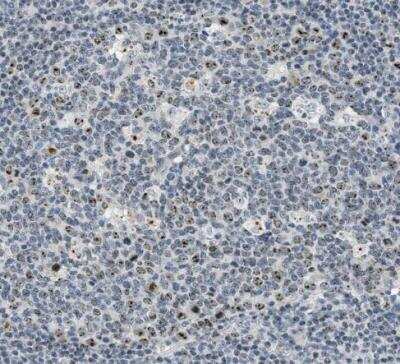 Immunohistochemistry-Paraffin DDX47 Antibody