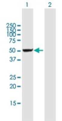 Western Blot: DDX47 Antibody [H00051202-B01P] - Analysis of DDX47 expression in transfected 293T cell line by DDX47 polyclonal antibody.  Lane1:DDX47 transfected lysate(50.05 KDa). Lane2:Non-transfected lysate.