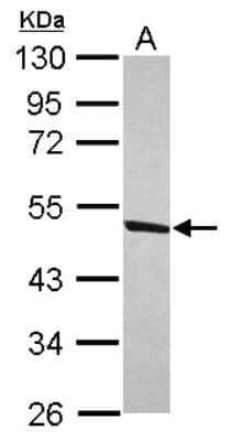 Western Blot: DDX47 Antibody [NBP2-16139] - Sample (30 ug of whole cell lysate) A: IMR32 10% SDS PAGE gel, diluted at 1:1000.