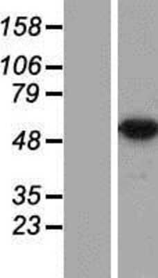 Western Blot: DDX47 Overexpression Lysate (Adult Normal) [NBP2-07049] Left-Empty vector transfected control cell lysate (HEK293 cell lysate); Right -Over-expression Lysate for DDX47.