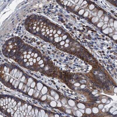 Immunohistochemistry-Paraffin: DDX49 Antibody [NBP2-48749] - Staining of human rectum shows strong cytoplasmic positivity in glandular cells.