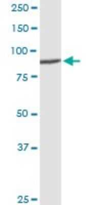 Western Blot: DDX50 Antibody [H00079009-D01P] - Analysis of DDX50 expression in human kidney.