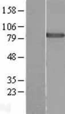 Western Blot: DDX50 Overexpression Lysate (Adult Normal) [NBL1-09802] Left-Empty vector transfected control cell lysate (HEK293 cell lysate); Right -Over-expression Lysate for DDX50.