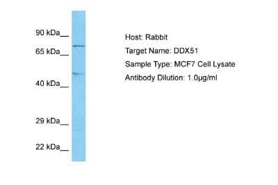 Western Blot: DDX51 Antibody [NBP2-87264] - Host: Rabbit. Target Name: DDX51. Sample Tissue: Human MCF7 Whole Cell lysates. Antibody Dilution: 1ug/ml