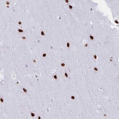 Immunohistochemistry-Paraffin: DDX52 Antibody [NBP2-33776] - Staining of human cerebral cortex shows strong nuclear positivity in neuronal cells.