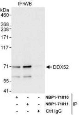 Immunoprecipitation: DDX52 Antibody [NBP1-71810] - Whole cell lysate (1 mg for IP, 20% of IP loaded) from HeLa cells.   Affinity purified rabbit anti-DDX52 antibody used for IP at 6 mcg/mg lysate.  DDX52 was also immunoprecipitated by rabbit anti-DDX52 antibody NBP1-71811, which recognizes a downstream epitope.