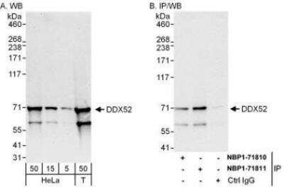 Western Blot: DDX52 Antibody [NBP1-71811] - Whole cell lysate from HeLa (5, 15 and 50 mcg for WB; 1 mg for IP, 20% of IP loaded) and 293T (T; 50 mcg) cells.  Affinity purified rabbit anti-DDX52 antibody used for WB at 0.04 mcg/ml (A) and 0.4 mcg/ml (B) and used for IP at 6 mcg/mg lysate.  DDX52 was also immunoprecipitated by rabbit anti-DDX52 antibody NBP1-71810, which recognizes an upstream epitope.