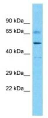 Western Blot: DDX52 Antibody [NBP3-10394] - Western blot analysis of DDX52 in Uterus tumor lysates. Antibody dilution at 1.0ug/ml