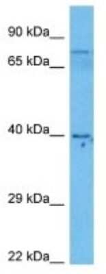 Western Blot: DDX52 Antibody [NBP3-10805] - Western blot analysis of DDX52 in Human Large Intestine Tumor lysates. Antibody dilution at 1ug/ml