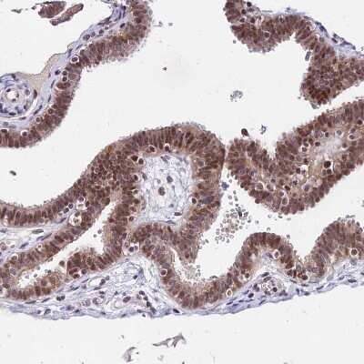 Immunohistochemistry-Paraffin: DDX55 Antibody [NBP2-47490] - Staining of human fallopian tube shows moderate nuclear and cytoplasmic positivity in glandular cells.