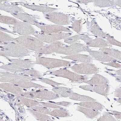 Immunohistochemistry-Paraffin: DDX55 Antibody [NBP2-47490] - Staining of human skeletal muscle shows no positivity in myocytes as expected.