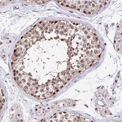Immunohistochemistry-Paraffin: DDX55 Antibody [NBP2-47490] - Staining of human testis shows strong nuclear and cytoplasmic positivity in cells in seminiferous ducts.