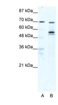 Western Blot: DDX55 Antibody [NBP1-57331] - Titration: 0.2-1 ug/ml, Positive Control: HepG2 cell lysate.