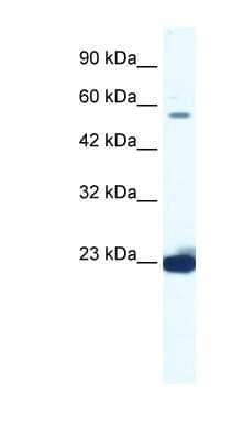 Western Blot: DDX55 Antibody [NBP1-57332] - Jurkat cell lysate, concentration 1.25ug/ml.