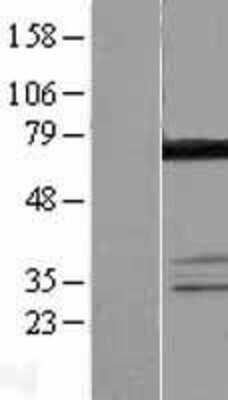Western Blot: DDX55 Overexpression Lysate (Adult Normal) [NBL1-09806] Left-Empty vector transfected control cell lysate (HEK293 cell lysate); Right -Over-expression Lysate for DDX55.