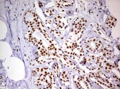 Immunohistochemistry: DDX56 Antibody (OTI2E5) - Azide and BSA Free [NBP2-71964] - Analysis of Human breast tissue. (Heat-induced epitope retrieval by 10mM citric buffer, pH6.0, 120C for 3min)