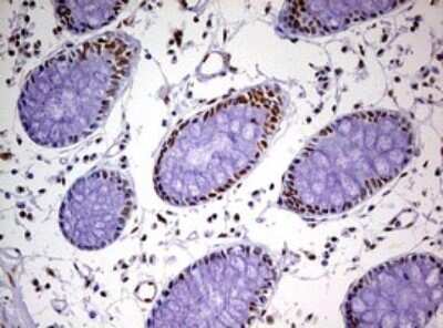 Immunohistochemistry: DDX56 Antibody (OTI2E5) - Azide and BSA Free [NBP2-71964] - Analysis of Human colon tissue. (Heat-induced epitope retrieval by 10mM citric buffer, pH6.0, 120C for 3min)